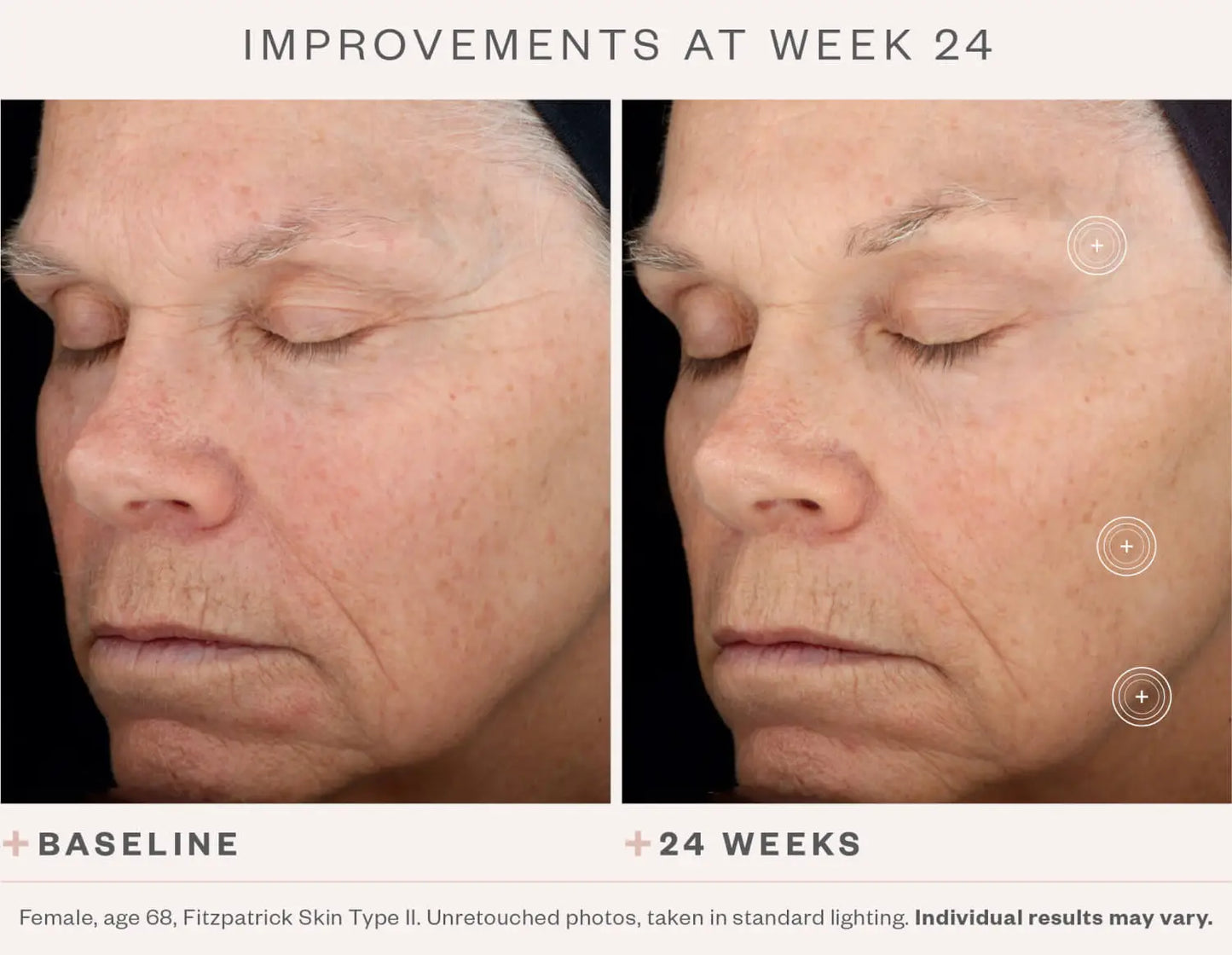 SkinMedica TNS Advanced+ Serum (1 oz.)