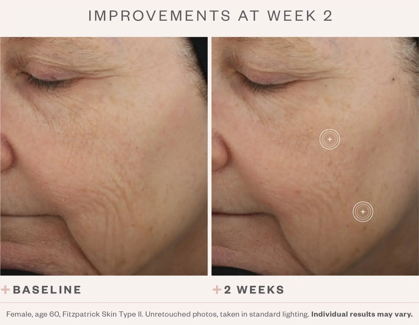 SkinMedica TNS Advanced+ Serum (1 oz.)