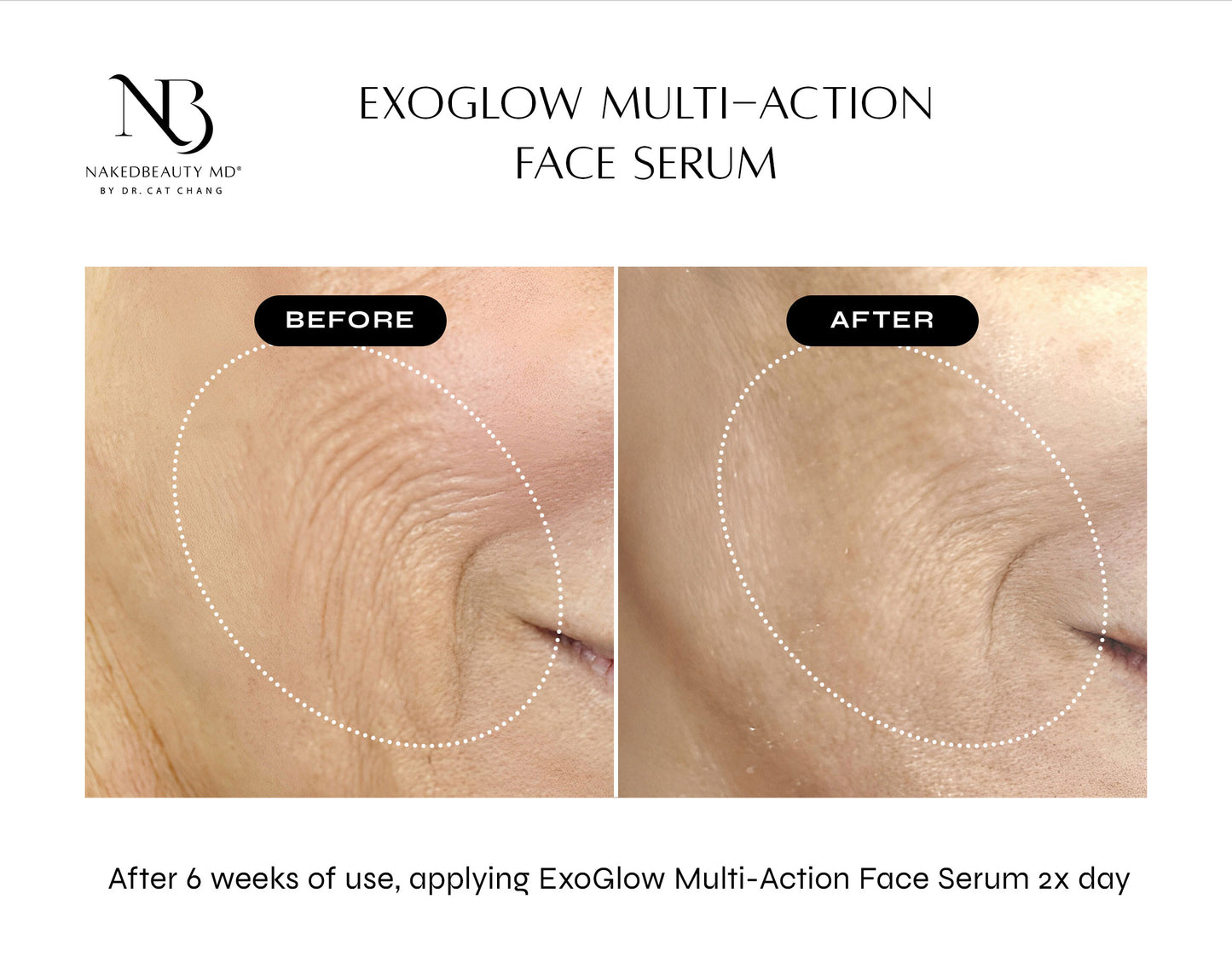 NAKEDBEAUTY MD™ ExoGlow Multi-Action Face Serum