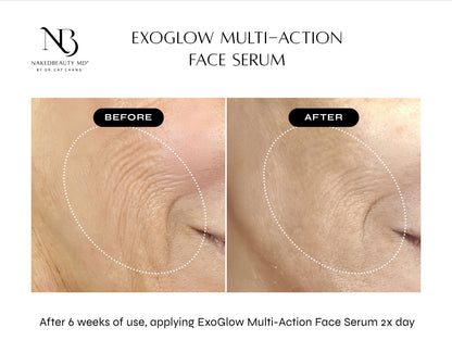 NAKEDBEAUTY MD™ ExoGlow Multi-Action Face Serum
