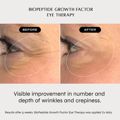 NAKEDBEAUTY MD™ BioPeptide Growth Factor Eye Therapy