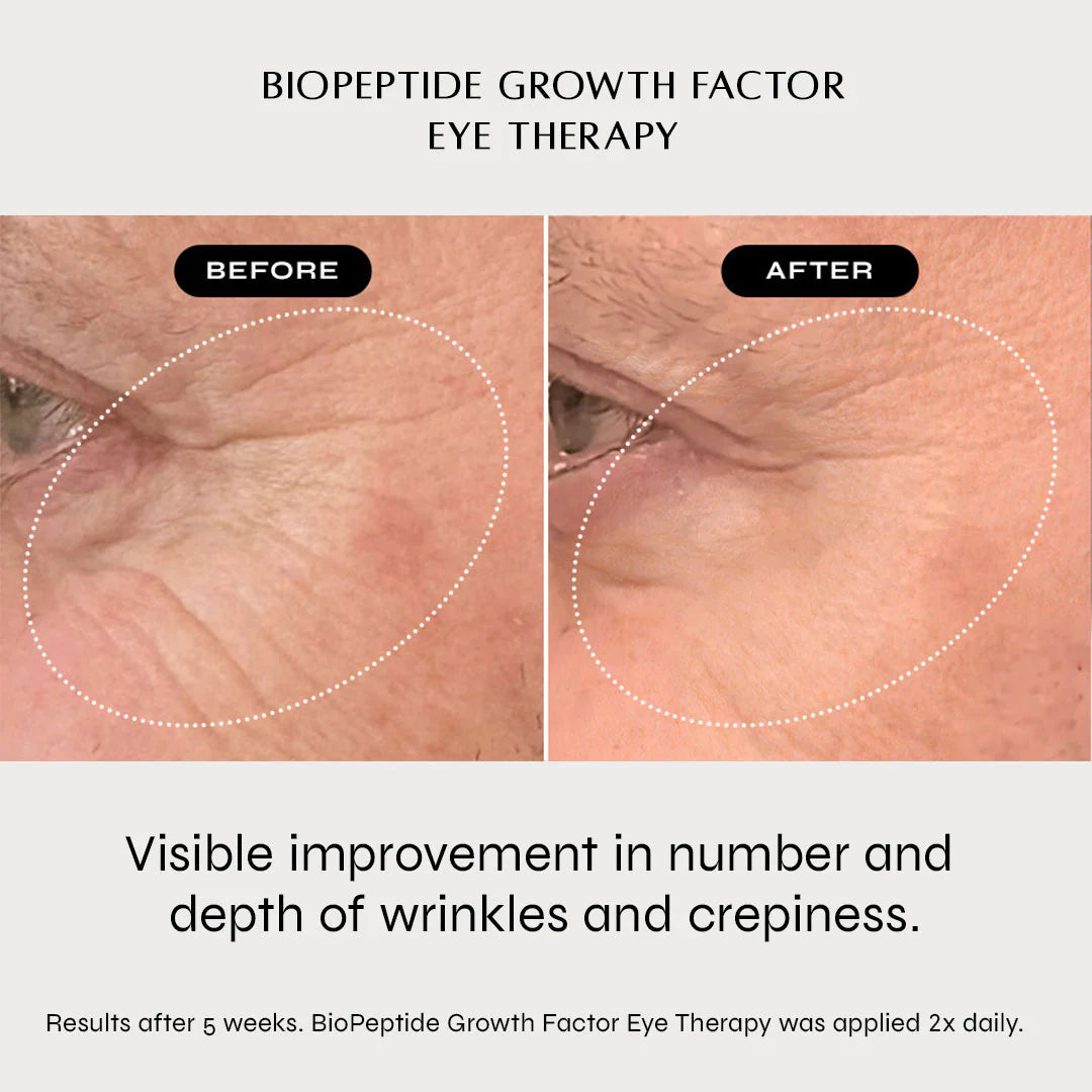 NAKEDBEAUTY MD™ BioPeptide Growth Factor Eye Therapy
