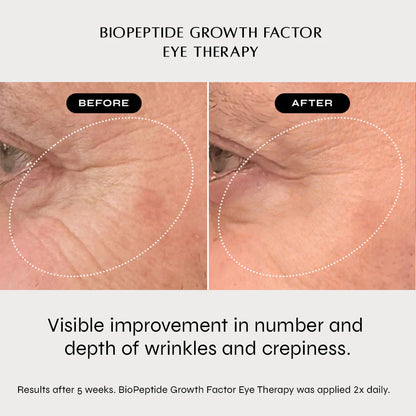 NAKEDBEAUTY MD™ BioPeptide Growth Factor Eye Therapy
