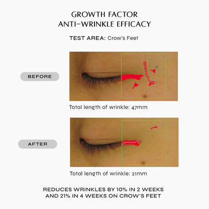 NAKEDBEAUTY MD™ BioPeptide Growth Factor Eye Therapy