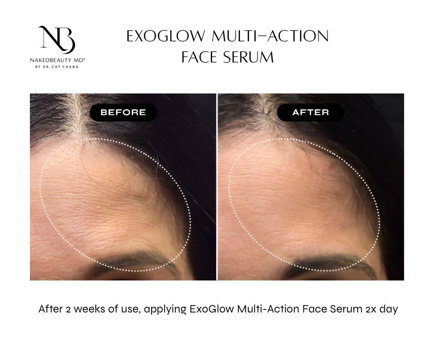 NAKEDBEAUTY MD™ ExoGlow Multi-Action Face Serum