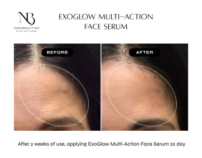 NAKEDBEAUTY MD™ ExoGlow Multi-Action Face Serum